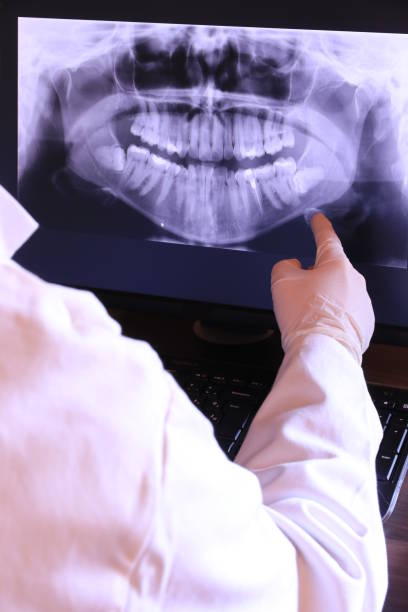 Best Emergency Broken Tooth Repair in Atchison, KS